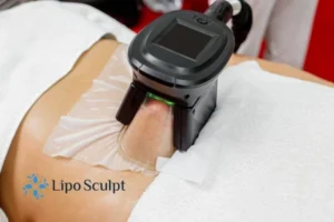 Are The Results From Aqualyx Permanent? 4 Compare Aqualyx Sale to other fat reduction treatments.