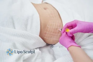 Are The Results From Aqualyx Permanent? 1 Do you want to know how long Aqualyx Sale results last?
