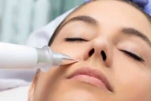 Best Actinic Keratoses Removal 3 Actinic keratoses Sale solutions - book in today!