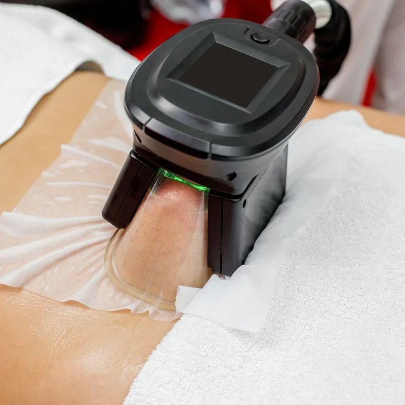 Fat Freezing treatment Sale